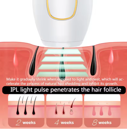 Depiladora Láser IPL Profesional – Depilación Permanente en Casa